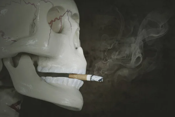 Κοντινό Πλάνο Του Τσιγάρο Καίγεται Κεφάλι Σκελετός Σκούρο Φόντο — Φωτογραφία Αρχείου