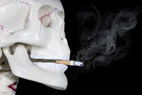 Gros Plan Crâne Humain Avec Cigarette Brûlée Arrière Plan Sombre — Photo