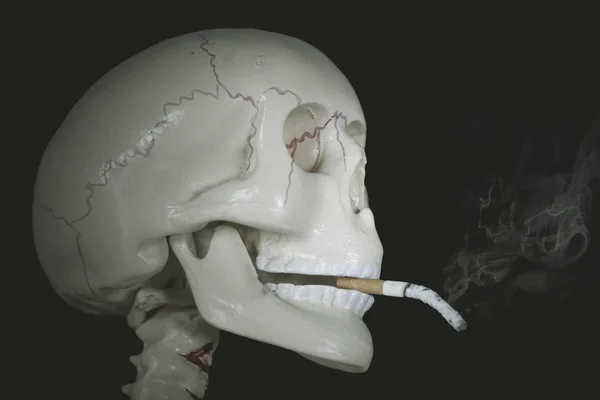 Close Human Head Skeleton Burned Cigarette Black Background — Stock Photo, Image