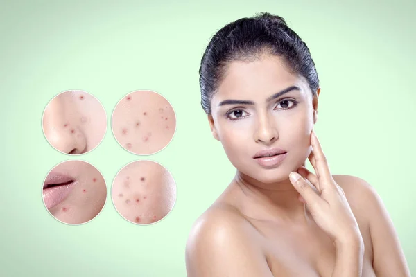 Bőr a nő előtt és után kezelés kozmetikai — Stock Fotó