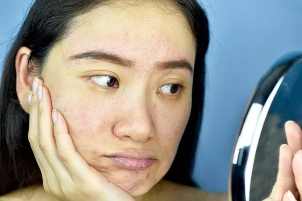 Mujer asiática mirándose en el espejo, sensación femenina molesta por su apariencia de reflejo muestran los signos de envejecimiento de la piel facial, arrugas, manchas oscuras, granos, cicatriz de acné, poros grandes, piel opaca . — Foto de Stock
