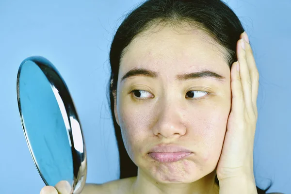 Asian woman looking at her facial problem in the mirror, Female feeling annoy about her reflection appearance show the aging skin signs, wrinkles, dark spot, pimple, acne scar, large pores, dull skin. — Stock Photo, Image