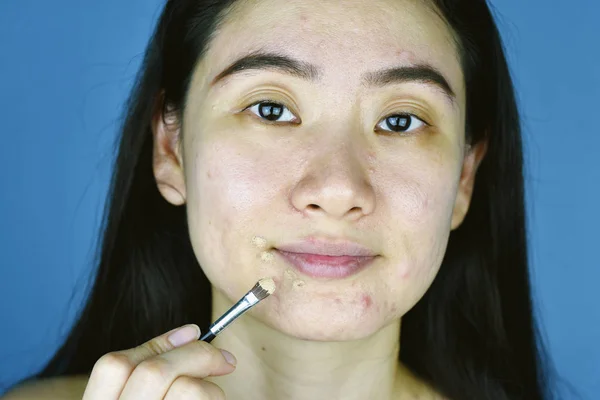 Cosméticos acné, mujer asiática aplicación de maquillaje corrector para ocultar el acné problema de la piel facial, granos corregir la cobertura . —  Fotos de Stock