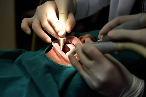 Examen des soins dentaires, Examen et traitement des dents par un dentiste en clinique dentaire, Visite annuelle pour le nettoyage et la mise à l'échelle des dents afin de prévenir les problèmes de maladies des gencives, Hygiène bucco-dentaire saine . — Photo