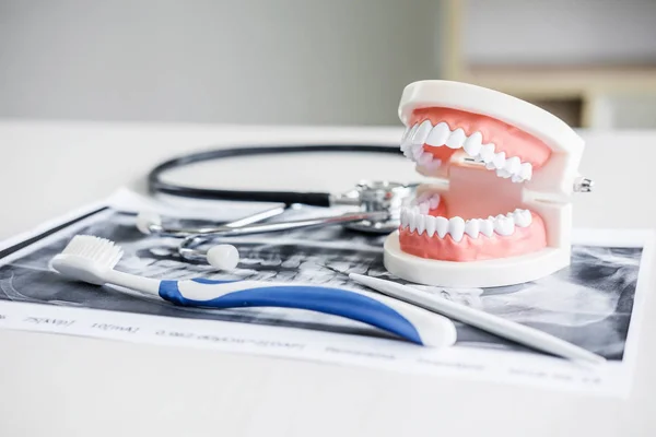 Dental model and equipment on tooth x-ray film and stethoscope used in the treatment of dental and dentistry by dentist.