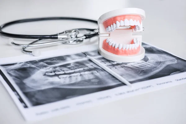 Dental modell och utrustning på tand x-ray film och stetoskop u — Stockfoto