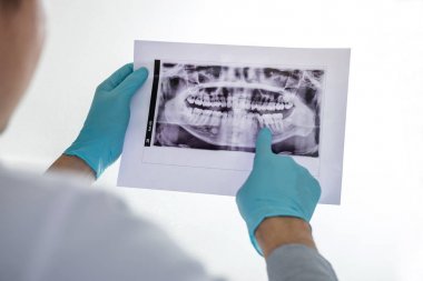 Erkek doktor veya diş hekimi nin diş x'ine bakarak görüntü-