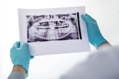 Erkek doktor veya diş hekimi nin diş x'ine bakarak görüntü-