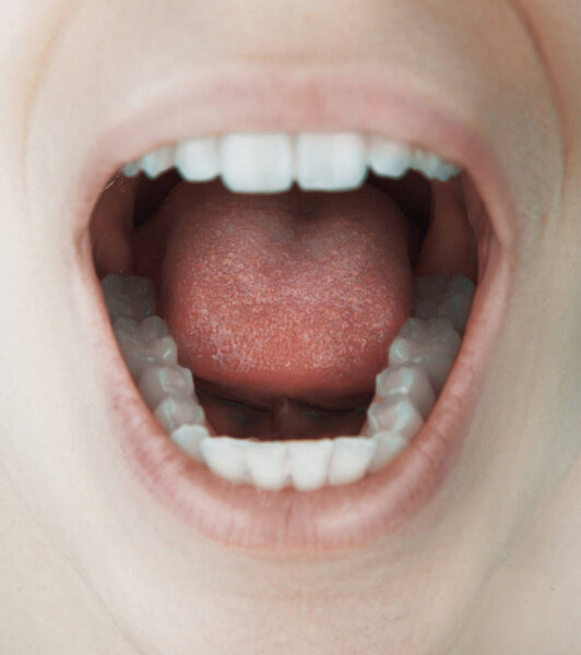 Open mouth with white teeth