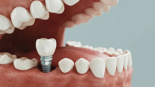 Cuidado Dental Renderizado —  Fotos de Stock