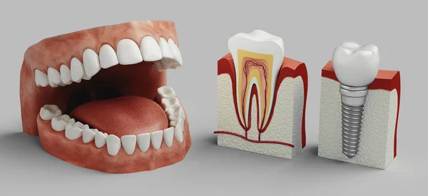 Cure Dentali Rendering — Foto Stock