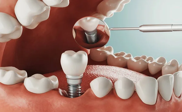 Cure Dentali Clinica Moderna Rendering — Foto Stock