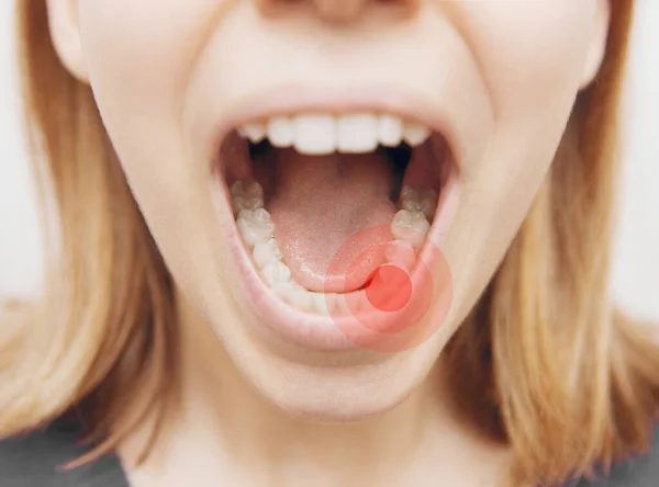 Primer plano de la mujer con la boca abierta durante el chequeo oral en el dentista. —  Fotos de Stock