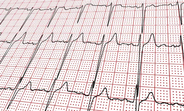 Cardiografía. Fragmento del resultado de la investigación por UC — Foto de Stock