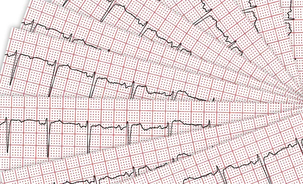 Cardiogram. Néhány kutatási eredmény a cu — Stock Fotó