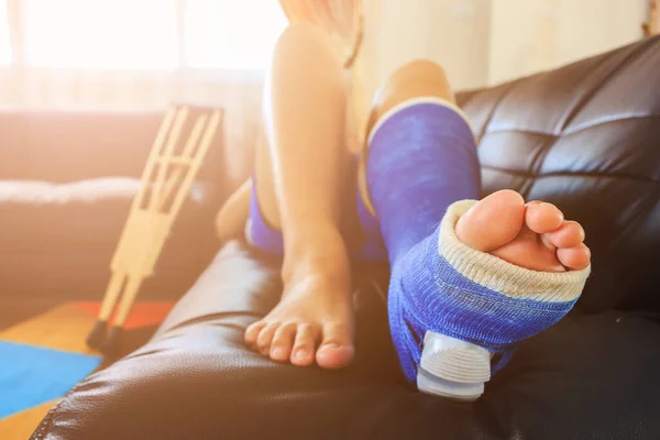 Gebroken Been Een Gips Gegoten Met Zachte Focus Achtergrond Licht — Stockfoto