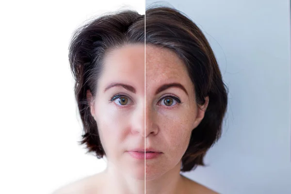 Hermosa mujer joven sobre un fondo blanco, belleza concept.retouch antes y after.face dividido en dos partes, mal estado de la piel en buen estado Imágenes De Stock Sin Royalties Gratis