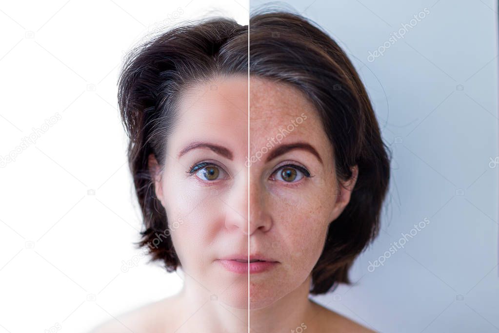 beautiful young woman on a white background, beauty concept.retouch before and after.face divided in two parts, poor condition the skin in good condition
