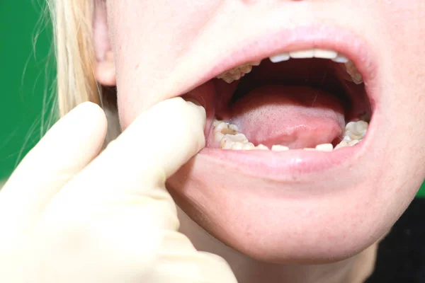 Preparation Surgery Remove Wisdom Teeth Eights — https://st4.depositphotos.com/12646980/24613/i/450/depositphotos_246139976-stock-photo-preparation-surgery-remove-wisdom-teeth.jpg