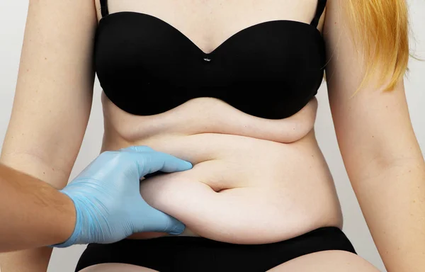 Karın germe ve torsoplasty: karın liposuction ve önlük kaldırılması. Plastik cerrah resepsiyonda hastaya