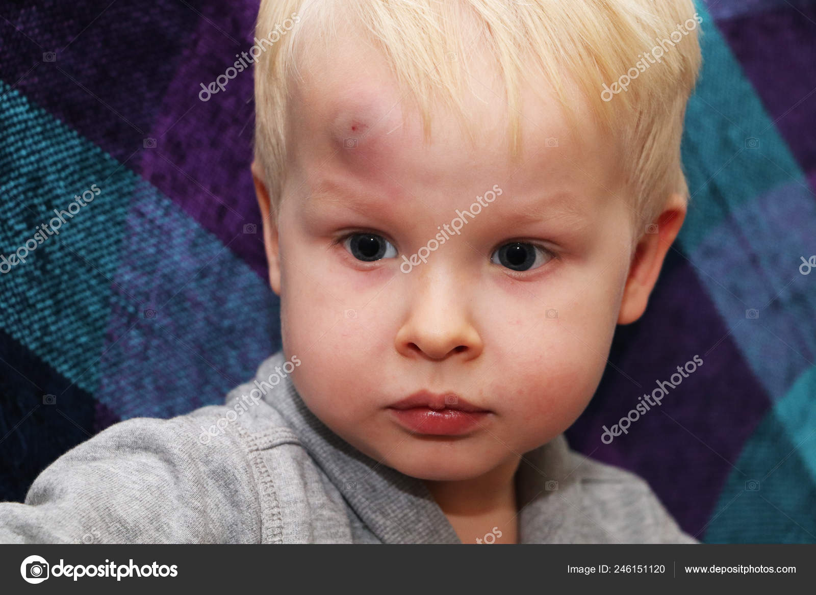 Enfant Bosse Tete Images Libres De Droit Photos De Enfant Bosse Tete Depositphotos