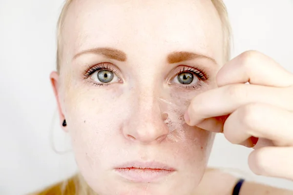 女孩从脸上取下面具膜 去除旧的干性皮肤的概念 自我护理 — 图库照片