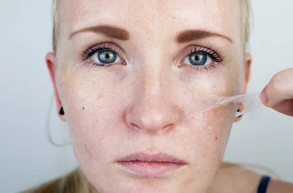 Girl Removes Mask Film Face Concept Removing Old Dry Skin — Stock Photo, Image