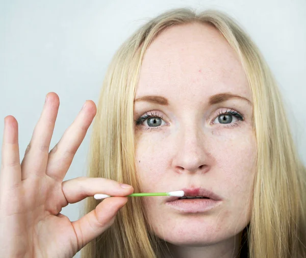 Mooie Jonge Vrouw Lippen Besmet Met Herpesvirus Het Concept Van — Stockfoto