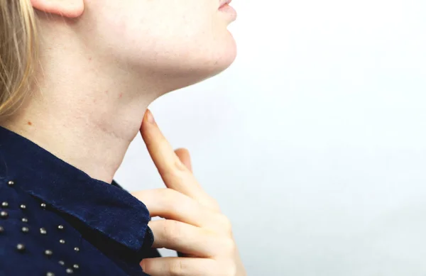 Thyroid Gland Closeup Portrait Cute Sick Young Blonde Woman White — Stock Photo, Image