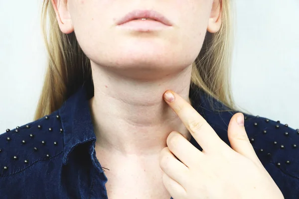 Щитовидная Железа Крупный План Портрета Симпатичной Больной Молодой Блондинки Белом — стоковое фото
