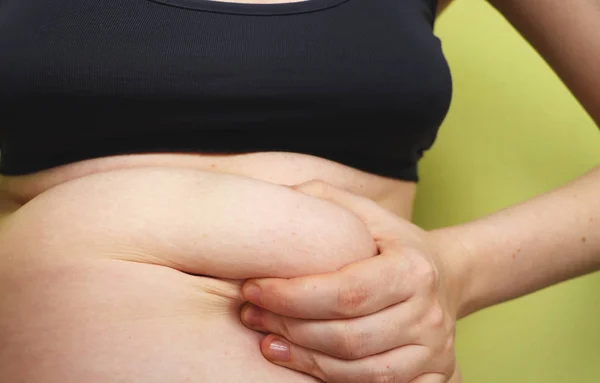 Koncept Nadváhy Tukové Záhyby Celulitida Hubnutí Liposukce — Stock fotografie