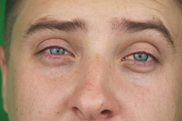 Слезы в глазах плачущего взрослого мужчины. Зеленый фон. Chromakey
