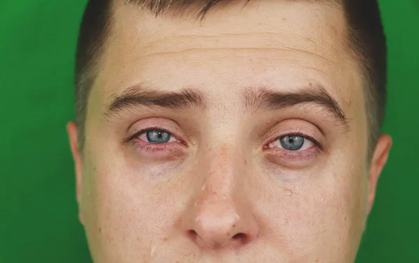 Tears in eyes of crying adult man. Green background. Chromakey