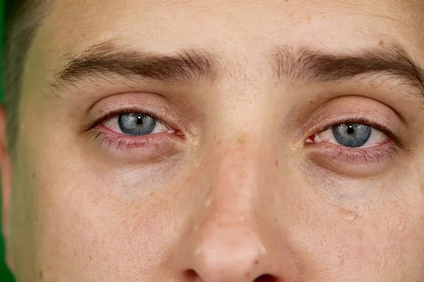Tränen Den Augen Eines Weinenden Erwachsenen Mannes Grüner Hintergrund Chromakey — Stockfoto