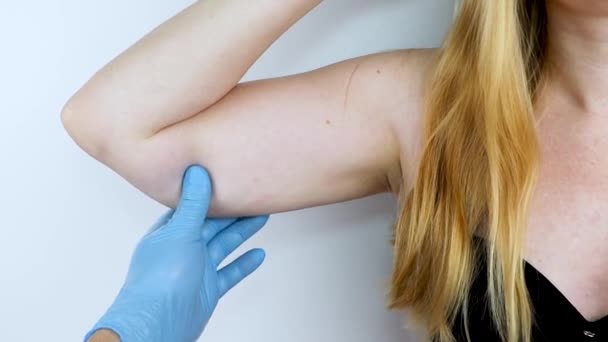 Пластичний Хірург Готується Затягнути Шкіру Рук Брахіопластика Пластикові Руки Висяча — стокове відео