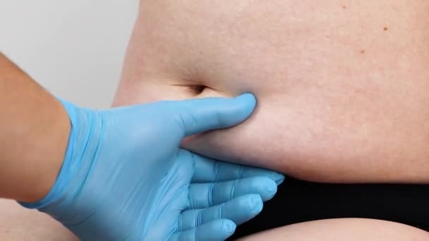 Abdominoplastik Und Torsoplastik Abdominale Fettabsaugung Und Entfernung Der Schürze Der — Stockvideo