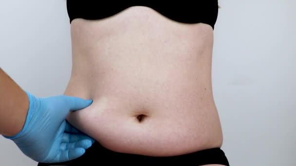 Abdominoplastia Torsoplastía Liposucción Abdominal Extirpación Del Delantal Paciente Recepción Cirujano — Vídeo de stock