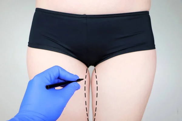Plastik cerrahi: femoroplasty, cruroplasty, kalça endoprosthetics, gluteoplasty. Bir plastik cerrah ile istişare hastaya