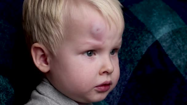 Big Bruise Forehead Little Boy — Stock Video