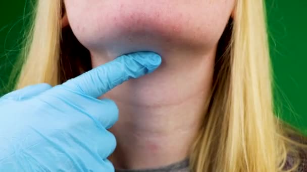 Abtasten Der Schilddrüse Und Des Rachens Untersuchung Durch Einen Arzt — Stockvideo