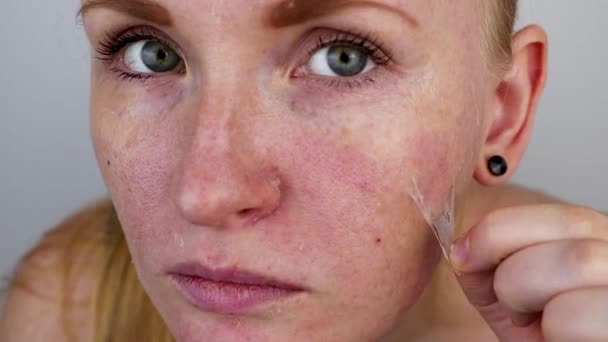 女孩从脸上取下面具膜 去除旧的干性皮肤的概念 自我护理 — 图库视频影像