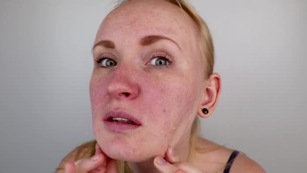 女の子は 顔からマスク フィルムを削除します 古い乾燥肌の取り外しの概念セルフケア — ストック動画