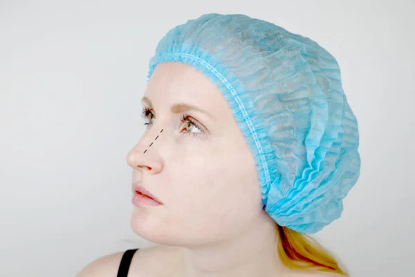 Rhinoplasty Patient Admission Plastic Surgeon She Has Nose — Stock Photo, Image