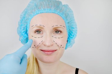 Yüz plastik cerrahi veya facelift, facelift, yüz düzeltme. Bir hasta daha önce plastik cerrahi plastik cerrah inceliyor.