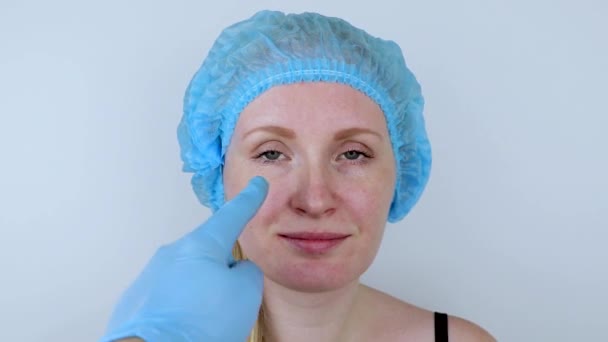 Facial Plastic Surgery Facelift Facelift Face Correction Plastic Surgeon Examines — Stock Video