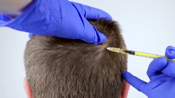 Mezoterapia Włosów Lub Przeszczep Włosów Kosmetyczka Lekarz Sprawia Zastrzyki Mans — Wideo stockowe