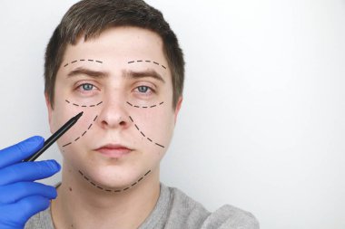 Plastik cerrahın resepsiyonunda bir adam. Plastik ameliyattan önce: kaş, alın, çene ve yanak Lift