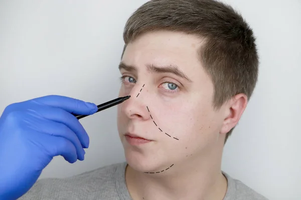 Hombre Recepción Del Cirujano Plástico Antes Cirugía Plástica Levantamiento Cejas —  Fotos de Stock