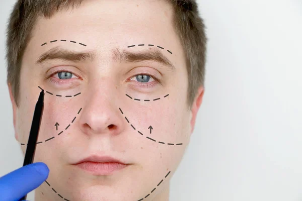 Man Reception Plastic Surgeon Plastic Surgery Eyebrow Forehead Chin Cheek — Stock Photo, Image