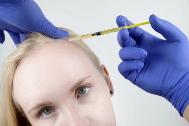 Saç mezoterapisi veya saç nakli: bir güzellik doktoru saç büyüme veya kellik önlemek için bir kadının kafasına enjeksiyonlar yapar